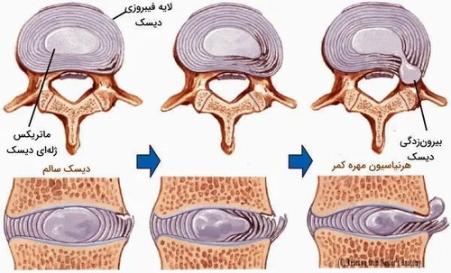 پزشکی بازساختی بافت غضروف هیالین